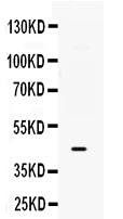 Anti-B3GNT8 Antibody Picoband®