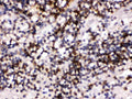 Anti-CD22 Antibody Picoband®