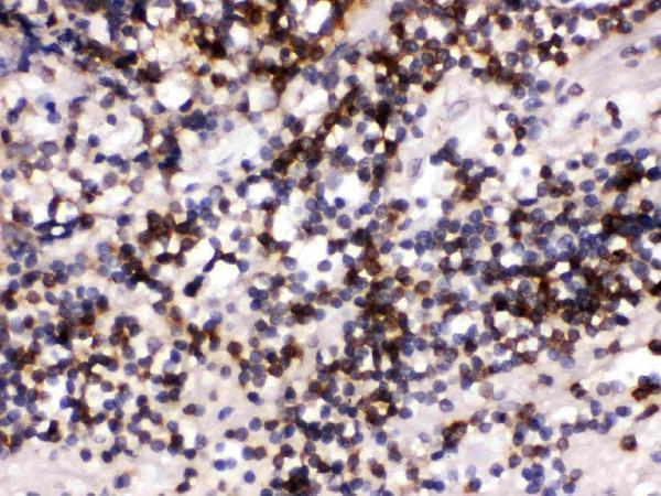 Anti-CD22 Antibody Picoband®