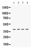 Anti-Caseine Kinase 1 alpha/CSNK1A1 Antibody Picoband®