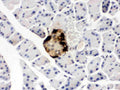 Anti-GLP1/GCG Antibody