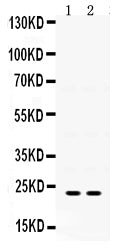 Anti-IGFBP5 Antibody Picoband®