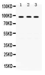 Anti-KAT2A/GCN5 Antibody Picoband®