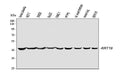 Anti-Cytokeratin 19/KRT19 Antibody Picoband®
