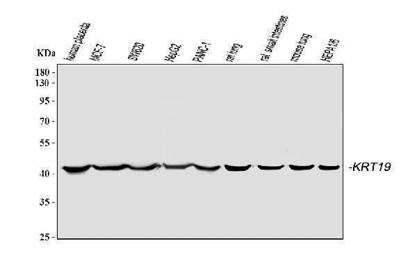 Anti-Cytokeratin 19/KRT19 Antibody Picoband®
