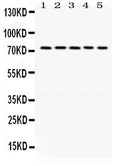 Anti-LIMK1 Antibody Picoband®
