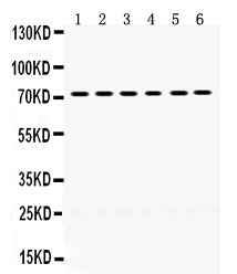 Anti-LIM kinase 2/LIMK2 Antibody Picoband®