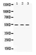 Anti-MMP1 Antibody Picoband®