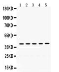 Anti-Oncostatin M/OSM Antibody Picoband®