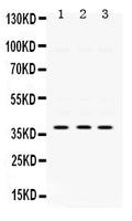 Anti-AMPK beta 1/PRKAB1 Antibody Picoband®