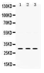 Anti-AMPK beta 2/PRKAB2 Antibody Picoband®