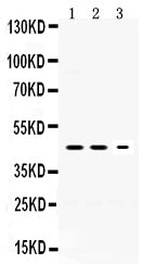 Anti-Neuroserpin/SERPINI1 Antibody Picoband®