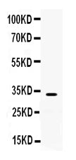 Anti-TREX1 Antibody Picoband®