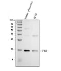 Anti-Prealbumin/TTR Antibody Picoband®