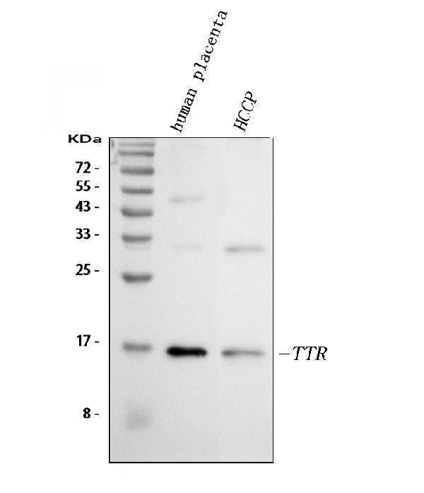 Anti-Prealbumin/TTR Antibody Picoband®
