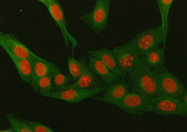 Anti-Mineralocorticoid Receptor/NR3C2 Antibody Picoband®