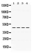 Anti-PAX6 Antibody Picoband®