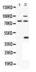 Anti-PACE4/PCSK6 Antibody Picoband®