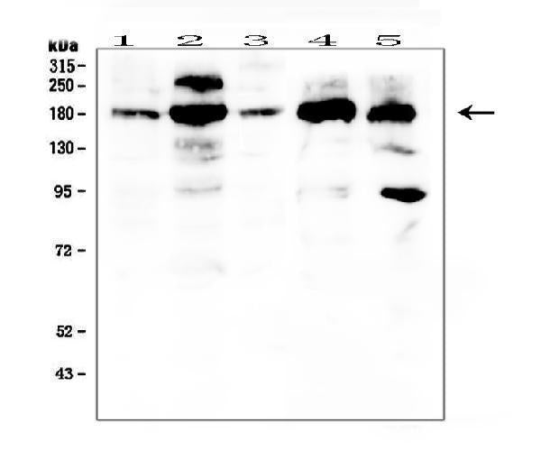Anti-PDGF Receptor alpha/PDGFRA Antibody Picoband®