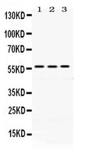 Anti-ERp57/PDIA3 Antibody Picoband®