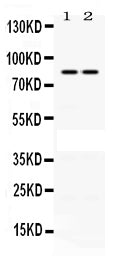 Anti-Phospholipase A2/PLA2G4A Antibody Picoband®