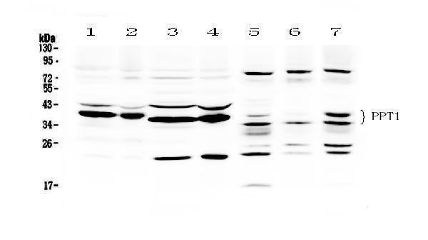 Anti-PPT1 Antibody Picoband®
