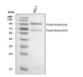 Anti-Prolactin Receptor/PRLR Antibody Picoband®
