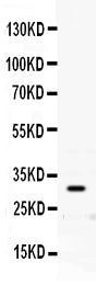 Anti-Prion protein PrP/PRNP Antibody Picoband®