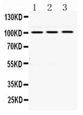 Anti-RASA1 Antibody Picoband®