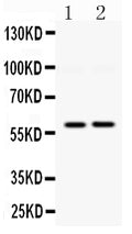 Anti-DGAT1 Antibody Picoband®