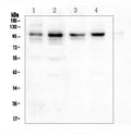 Anti-PSD95/DLG4 Antibody Picoband®