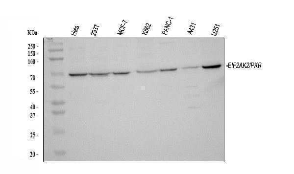 Anti-PKR/EIF2AK2 Antibody Picoband®