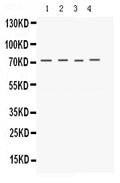 Anti-Kv1.4/KCNA4 Antibody Picoband®