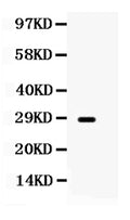 Anti-Aquaporin 0/MIP Antibody Picoband®