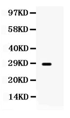 Anti-Aquaporin 0/MIP Antibody Picoband®