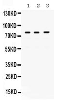 Anti-DNA polymerase eta/POLH Antibody Picoband®