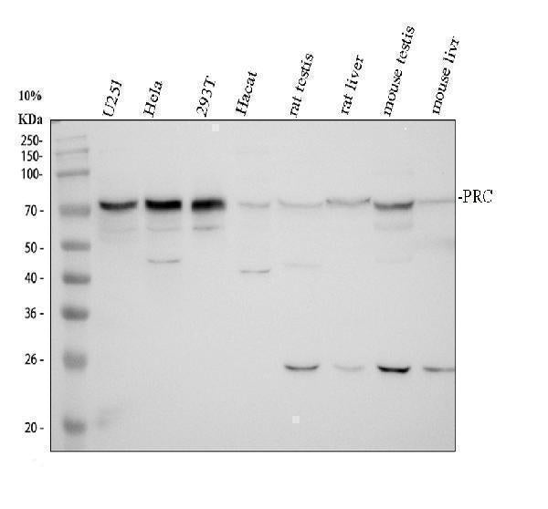 Anti-PRC1 Antibody Picoband®