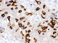 Anti-RRM2 Antibody Picoband®