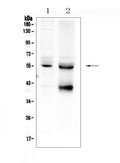 Anti-TGF beta Receptor I/TGFBR1 Antibody Picoband®