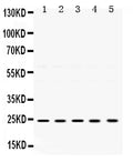 Anti-TIMP2 Antibody Picoband®