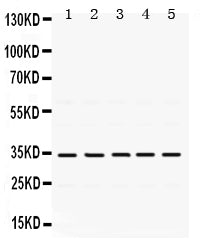 Anti-TIMP3 Antibody Picoband®