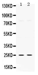 Anti-Thymidine Kinase 1/TK1 Antibody Picoband®