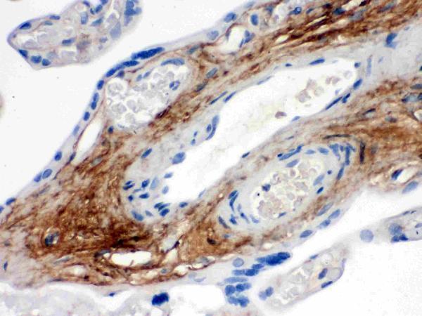 Anti-TNXB Antibody Picoband®