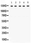 Anti-TRPM8 Antibody Picoband®