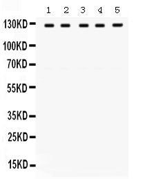 Anti-TRPM8 Antibody Picoband®