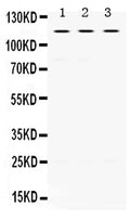 Anti-UNC5C Antibody Picoband®