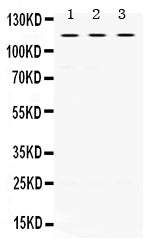 Anti-UNC5C Antibody Picoband®