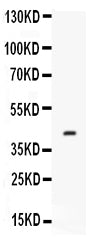 Anti-Factor D/CFD Antibody Picoband®
