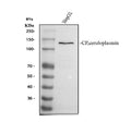 Anti-Ceruloplasmin/CP Antibody Picoband®