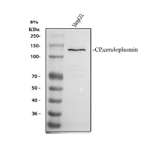 Anti-Ceruloplasmin/CP Antibody Picoband®